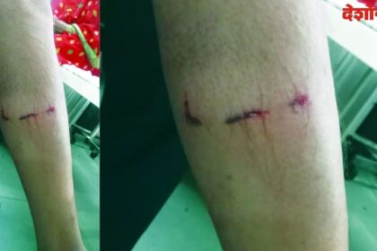 Dog Bite
