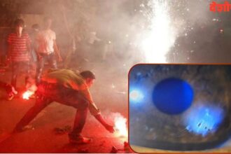 Crackers Eye Injury