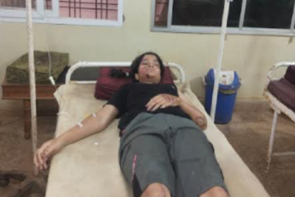 Bike Accident